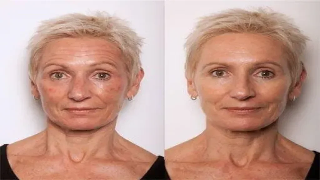 Beauty age skin - vélemények - árak - rendelés - összetétel - gyógyszertár - vásárlás - Magyarország - hozzászólások