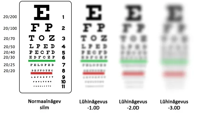 Oculax